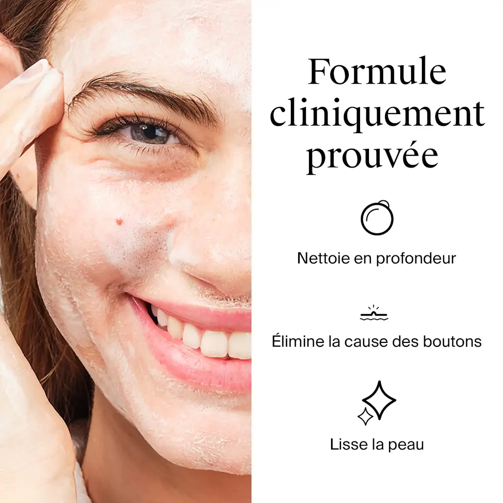 NEUTROGENA ANTI-BOUTON GEL TUNISIE